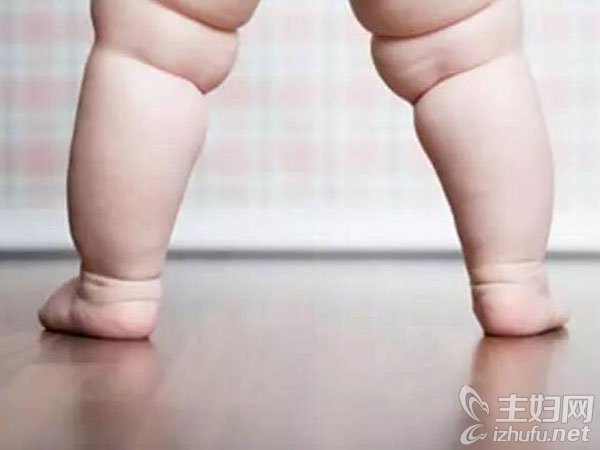 罗圈腿会遗传吗 罗圈腿如何矫正