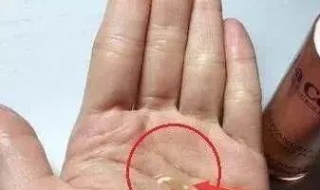 还有人喜欢自制护肤品，每晚用几滴擦脸，不长皱纹、不长斑