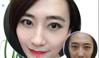 每天必做这事，形成了眼袋！