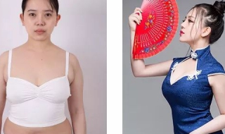 吸脂减重，体重没咋变，为啥曲线却如此博眼球？