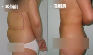 4种减肥类型，最终减成第二种的？