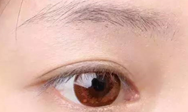 眉毛稀少怎么办 4种多见方法缓解这项困扰