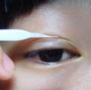 双眼皮贴怎么贴 简单步骤教程闭眼不尴尬