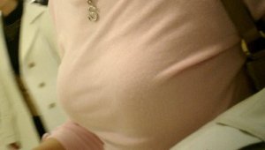 胸大的人乳房下垂怎么办 胸部下垂松弛怎么调整解决