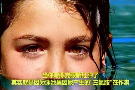 武汉一家四口全中招 红眼病原来传染性这么强！