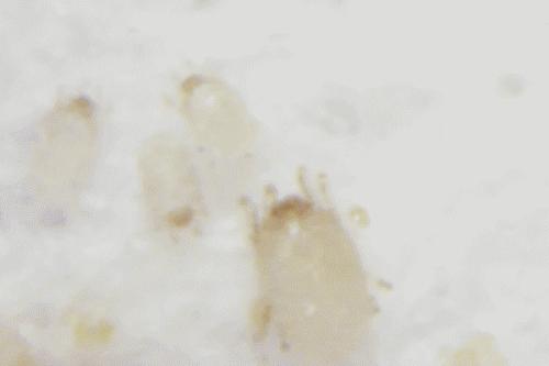 脸上有螨虫 脸上有螨虫怎么办?