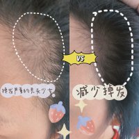 再也不想掉发了 | 美岛水肌养发增发精华液
