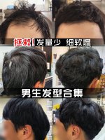 男生头发细软塌怎么办 救星！男生发量少软塌怎么做头发？