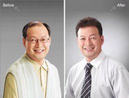 织发补发是怎么回事 男士织发补发图片