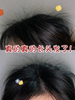 3️⃣0️⃣天长出小绒发防脱生发|养发护发篇